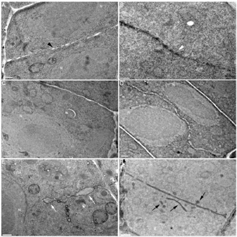 Cell plate formation is delayed in pas2-1 mutant. (A) Kinetics of early... | Download Scientific ...