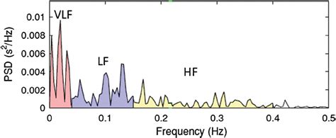 Fft Spectrum Of Ecg Signal Representing Different Frequency Bands