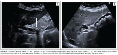 Adequacy Of Ultrasound Reports In Patients Presenting With Obstructive