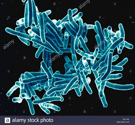 Mycobacterium Tuberculosis Banque Dimage Et Photos Alamy