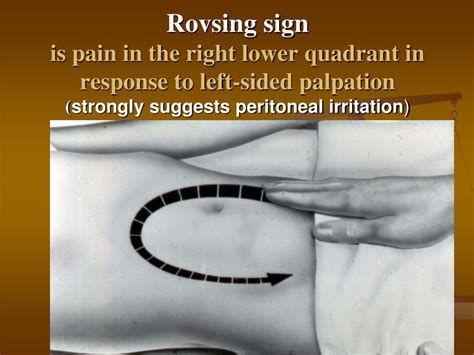 Ppt Purulent Inflammatory Diseases Of Abdominal Cavity Assprof Dr