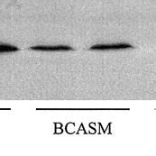 Western Immunoblot Showing Fk Binding Protein Fkbp In