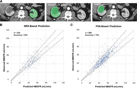 Ju Insight Limitations Of Parenchymal Volume Analysis For Estimating