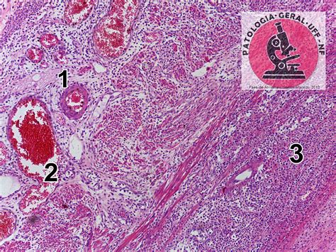 General Pathology UFF/NF | Active and passive hyperemia