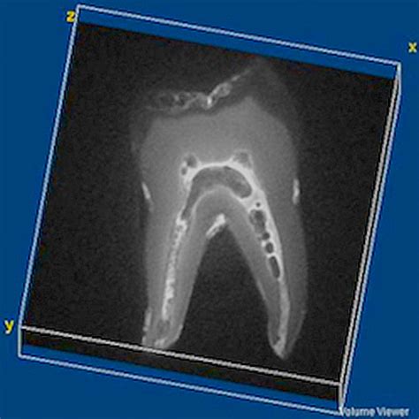 mri  medical imaging  dental mri study yields  images