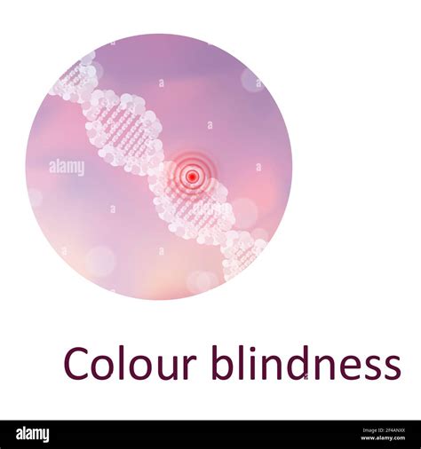 Colour blindness, illustration Stock Photo - Alamy