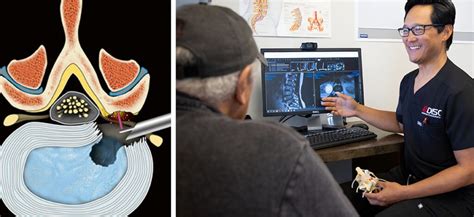 role  lasers  minimally invasive spine surgery