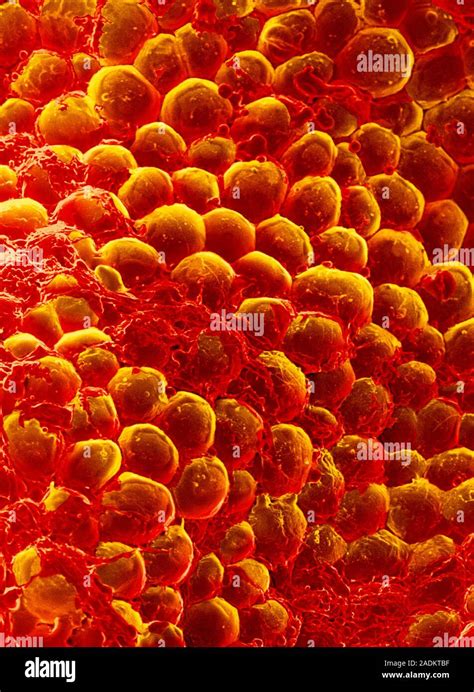 Adipose Tissue Coloured Scanning Electron Micro Graph Sem Of The