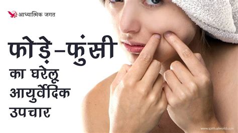 Homemade Remedies For Boils And Pimples फोड़े फुंसी का घरेलू