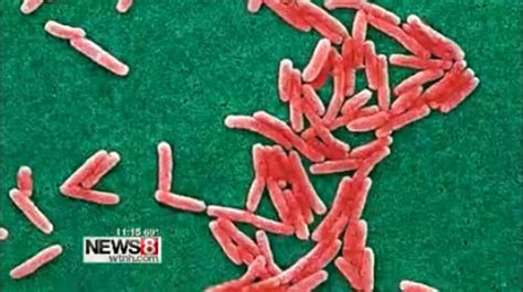 State Confirms Case Of Legionnaires Disease At Ct Valley Hospital