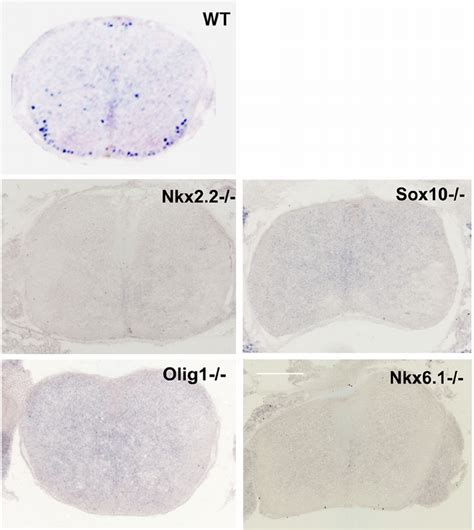 Tcf Expression Is Ablated Or A Ttenuated In Multiple Hypomyelination