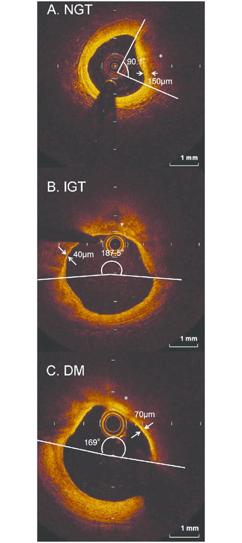 Representative Cross Sectional Oct Images For Each Of The Groups