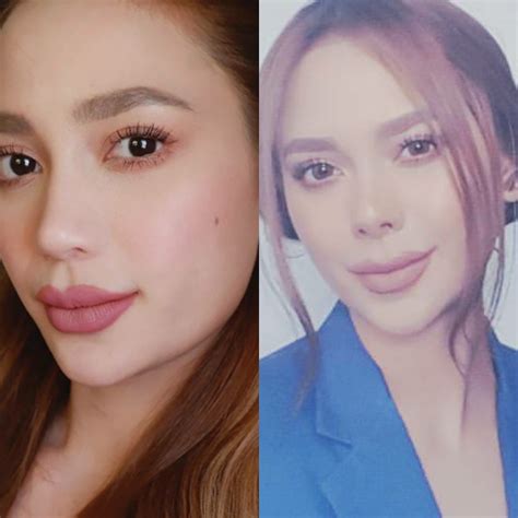 Arci Muñoz had a nose job? See before and after photos! | MyKiRu IsYuSeRo