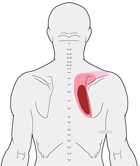 Pain Between Shoulder Blades When Slouching Integrative Works