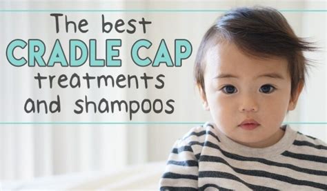 The 5 Best Cradle Cap Treatments And Shampoos Dandruff Deconstructed