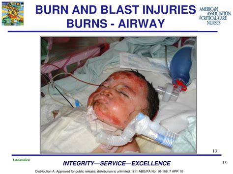 Ppt Burn And Blast Injuries Capt Regan Miller Cstars Powerpoint