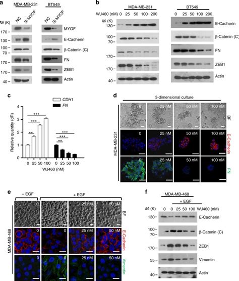 A Small Molecule Targeting Myoferlin Exerts Promising Anti Tumor