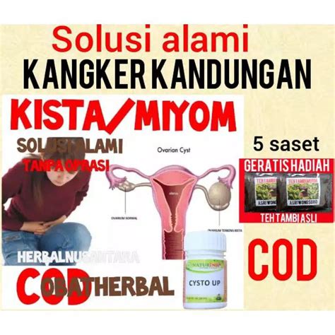 Jual Obat Herbal Kista Ovarium Bartholin Obat Miom Yang Paling Ampuh