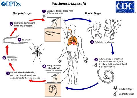 Wuchereria Bancrofti Morphology Life Cycle And Pathogenesis