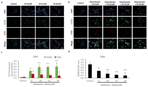 Ijms Free Full Text Zileuton A 5 Lipoxygenase Inhibitor