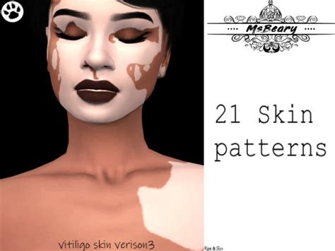 The Sims Resource: Vitiligo V3 by MsBeary • Sims 4 Downloads