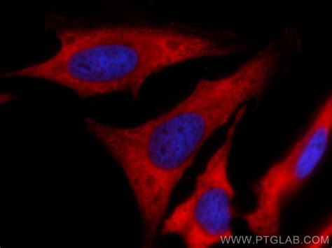 Inos Antibody Cl Proteintech