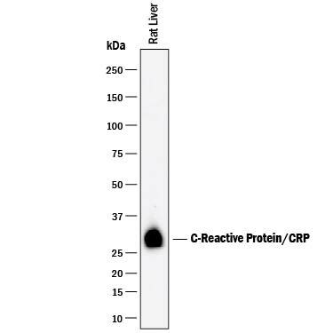 Rat C Reactive Protein Crp Antibody Af By R D Systems Part Of