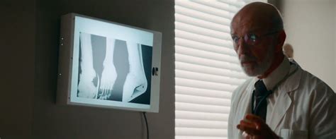 ligament bands  hold  joint togetherbut rickey