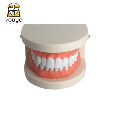 Dental Caries Standard Teeth Teaching Model Für Kinder Mundpflege