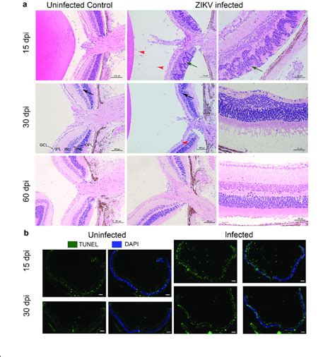 ZIKV Infection Induces Apoptosis And Damages The Architecture Of The