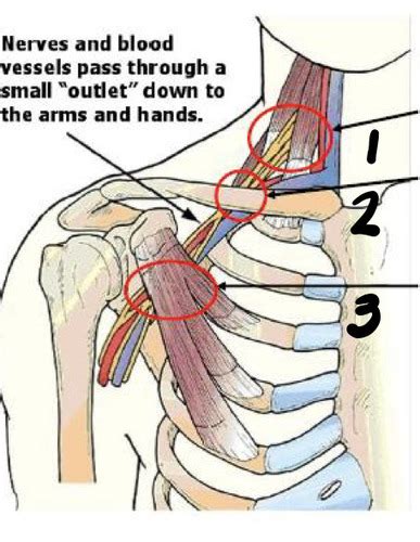 Brachial Plexus Flashcards Quizlet