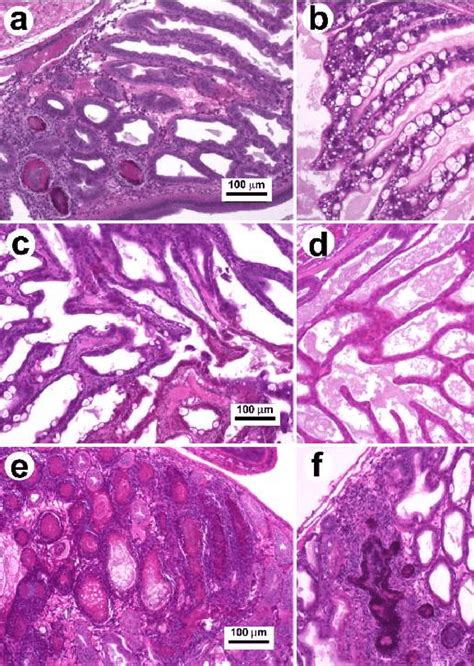 Photomicrograph Of The P Vannamei S Hepatopancreas Hp Affected With