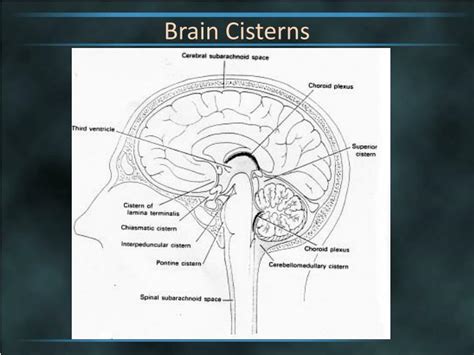 Ppt Brain Cisterns Powerpoint Presentation Id2263744