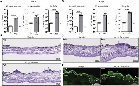 The Skin Commensal Yeast Malassezia Triggers A Type 17 Response That