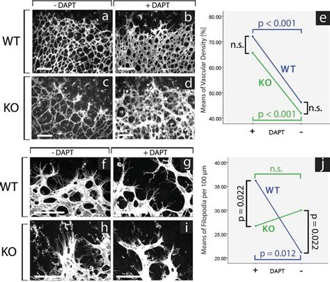 Effects Of Notch Signaling Inhibition In Wildtype And Norrin Knockout