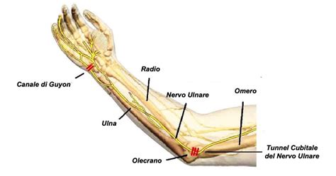 Mano Benedicente Lesione Del Nervo Ulnare Fisioscience