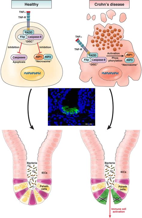 Complex Roles Of Caspases In The Pathogenesis Of Inflammatory Bowel