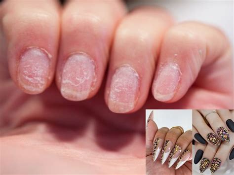 Tips To Repair Damaged Nails After Getting Gel Or Acrylic Extensions