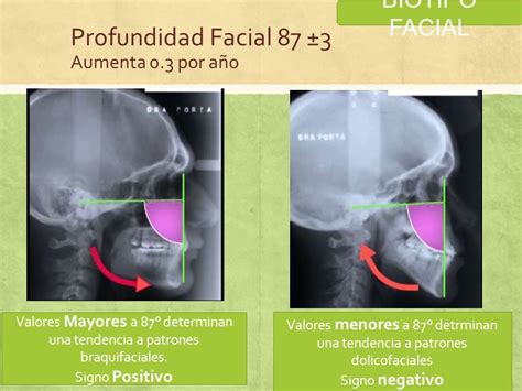 Biotipo Facial El Termino Biotiofacial Es Utilizado En Odontolog A