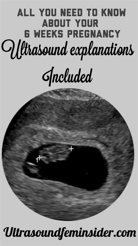 Normal first trimester 6 weeks ultrasound. - Ultrasoundfeminsider