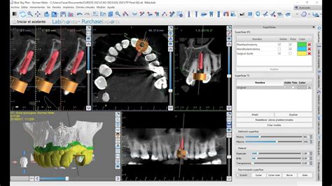 Cerik D Vivo Curso Guia Quirurgicas D En Blue Sky Bio Plan