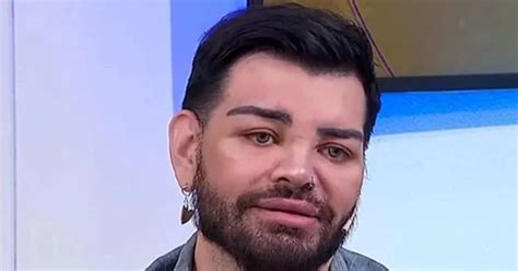 Homem faz mais de 30 plásticas para se parecer Ricky Martin