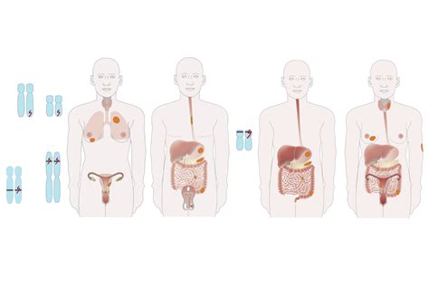 Hereditary Gastrointestinal Polyposis Syndromes Ueg United European