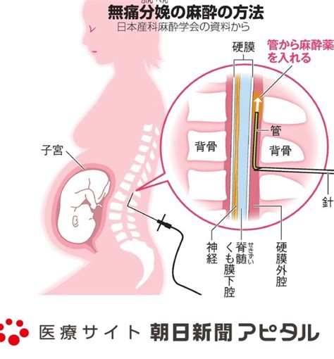 計画無痛分娩 43歳高齢初産のブログ