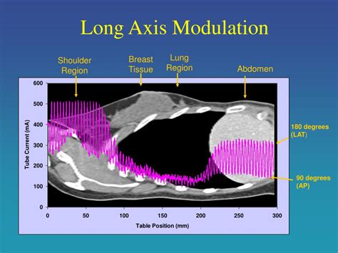 Ppt Ct Organ Dose Part 1 Estimating Organ Dose For Patients