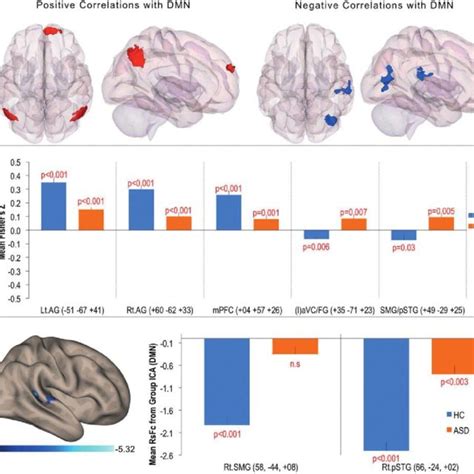 A Between Group Hcs Vs Asd Functional Connectivity Maps Of Download Scientific Diagram