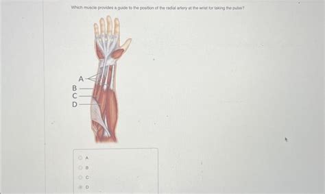 Solved Which muscle is an antagonist to the biceps brachil | Chegg.com