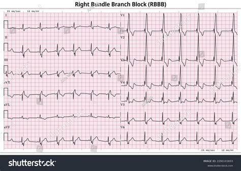 51 張 Rbbb 圖片、庫存照片和向量圖 | Shutterstock