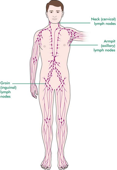 Swollen Lymph Nodes In The Groin Metromale Clinic Fertility, 54% OFF