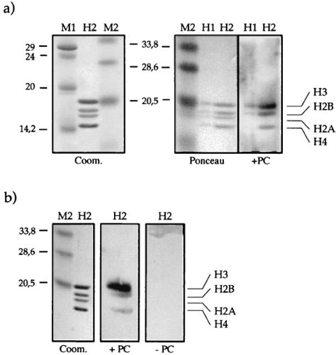 Far Western Blot Analysis With Drosophila Core Histones And Recom Download Scientific Diagram